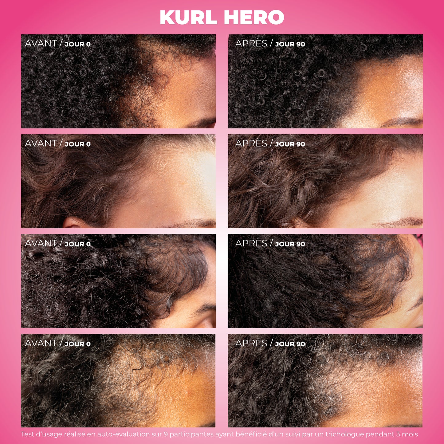 Kurl Hero - Serum croissance